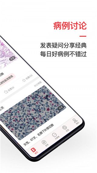 爱病理app手机赚钱软件截图2